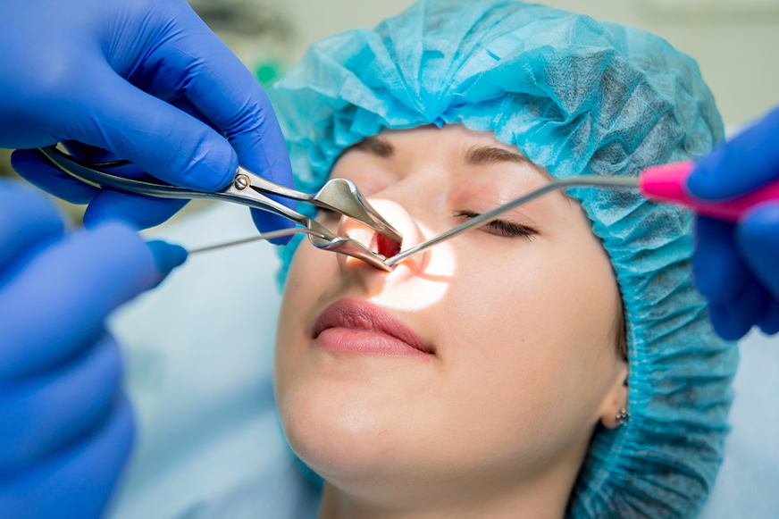 Endoskopik Sinüs Cerrahisi