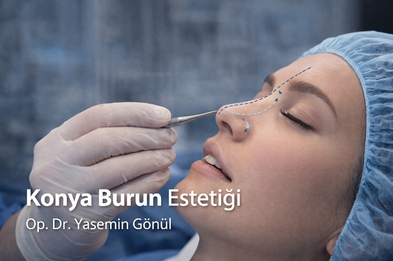 Konya Burun Estetiği (Rinoplasti) – Op. Dr. Yasemin Gönül