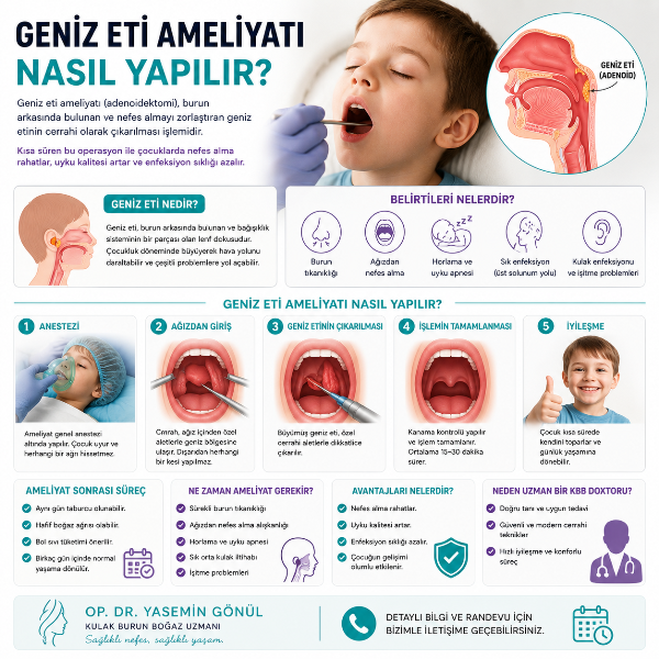 Geniz Eti Ameliyatı Nasıl Yapılır? (Adenoidektomi)